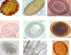 collage_of_various_helminth_eggs.