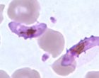 恶性疟原虫的配子细胞在薄血液中