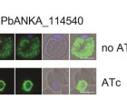 berghei疟原虫中PTEX的HSP101成分的诱导型敲低（在存在藻类的ATC中）。这种消融阻止了55kDa向宿主的红细胞细胞质出口（如在没有ATC的情况下），而是积聚在寄生虫液泡中（图像由Tania de Koning Ward提供）。