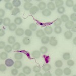 兰氏锥虫血型锥虫蛋白常被误认为是克鲁兹锥虫血型锥虫蛋白，导致不必要和危险的治疗