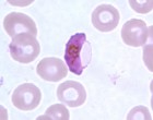A Plasmodium gametocyte (image from CDC)