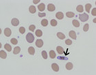 796px-p._falciparum_thin_smear_gametocyte