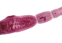 800年px-echinococcus-multilocularis-adult