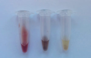 血液喂养的蚊子腹部被粉碎成不同程度的消化程度的溶液。从左到右：最近（<24小时）血液喂养的蚊子，血液喂养后2-4天，血液喂食4天以上。资料来源：V Brugman。