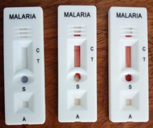 疟疾快速诊断测试